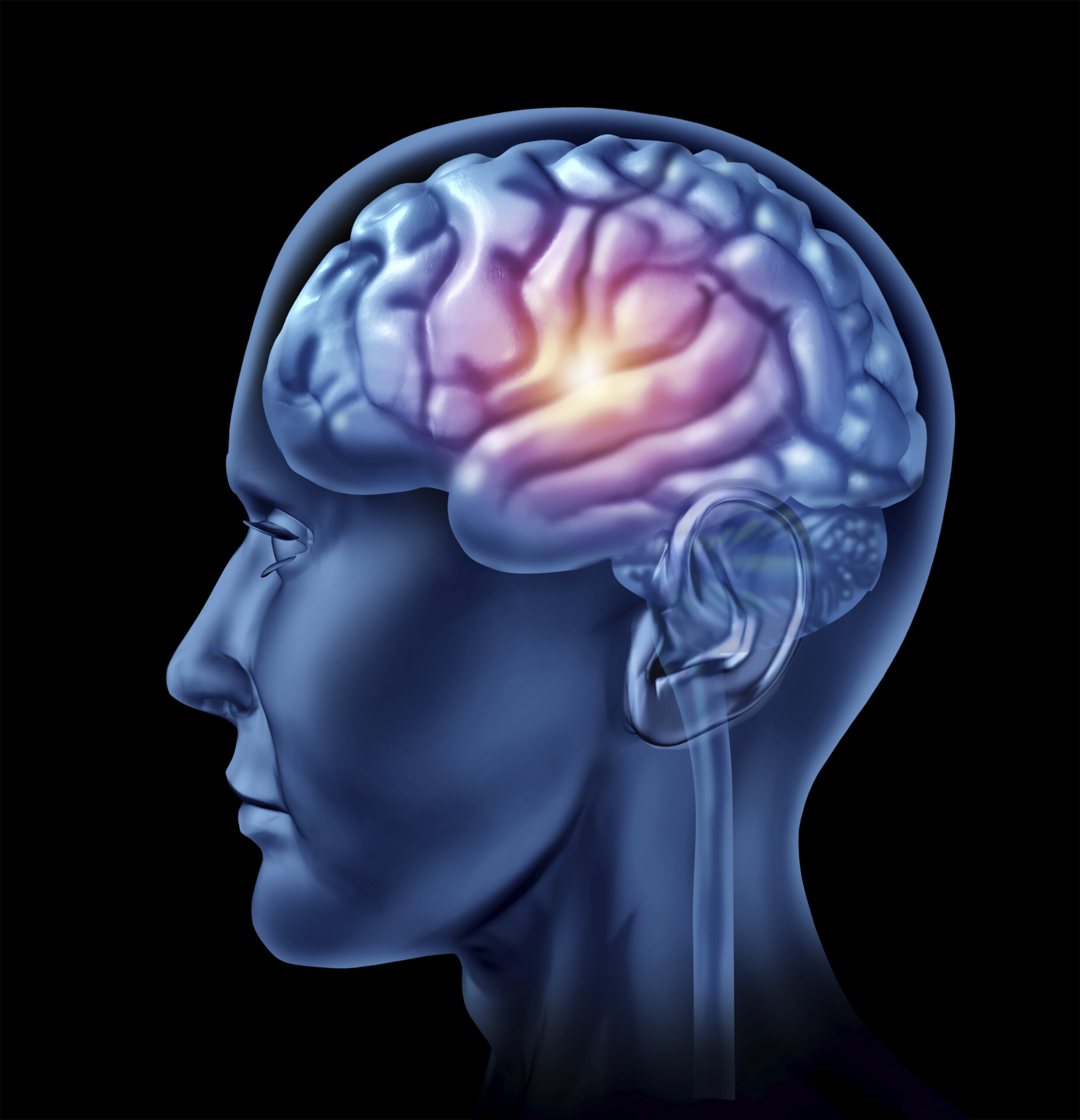 mild traumatic brain injury; concussion symptoms
